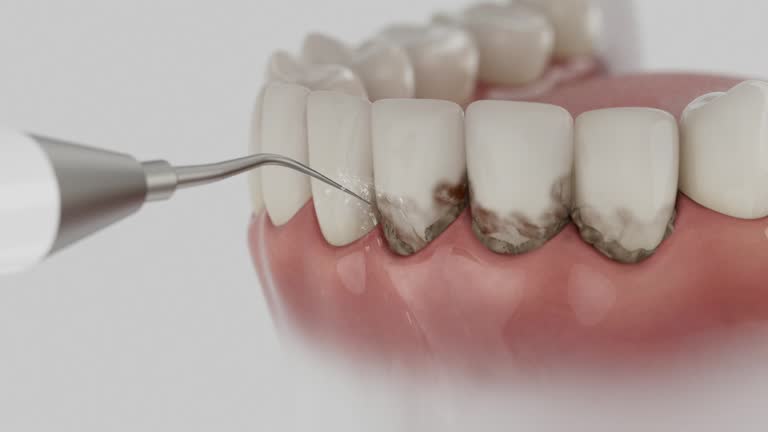 Reliable Dental Implants contractor in Gerald, MO by Smile Center Dentistry